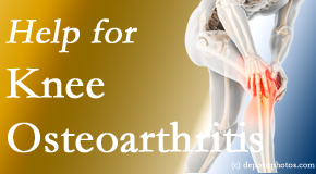 Pure Chiropractic shares recent studies regarding the exercise recommendations for knee osteoarthritis relief, even exercising the healthy knee for relief in the painful knee!