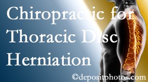 Pure Chiropractic diagnoses and treats thoracic disc herniation pain and relieves its symptoms like unexplained abdominal pain or other gastrointestinal issues.