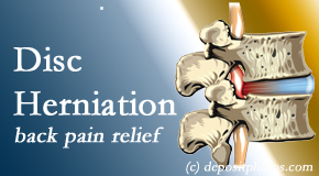 Pure Chiropractic uses non-surgical treatment for relief of disc herniation related back pain.